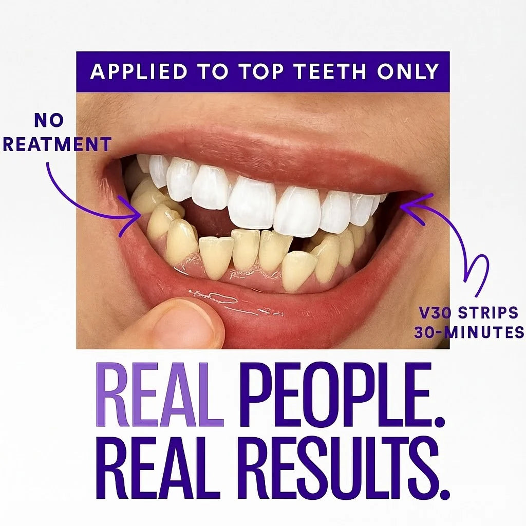 Amzoo Purple Teeth Whitening Strips